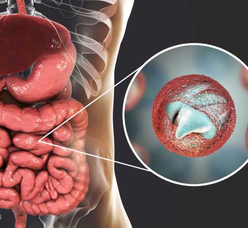symptoms of parasitic infections